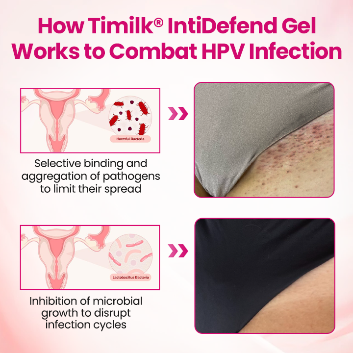 Cpviat® IntiDefend Anti-HPV Interferon Gel